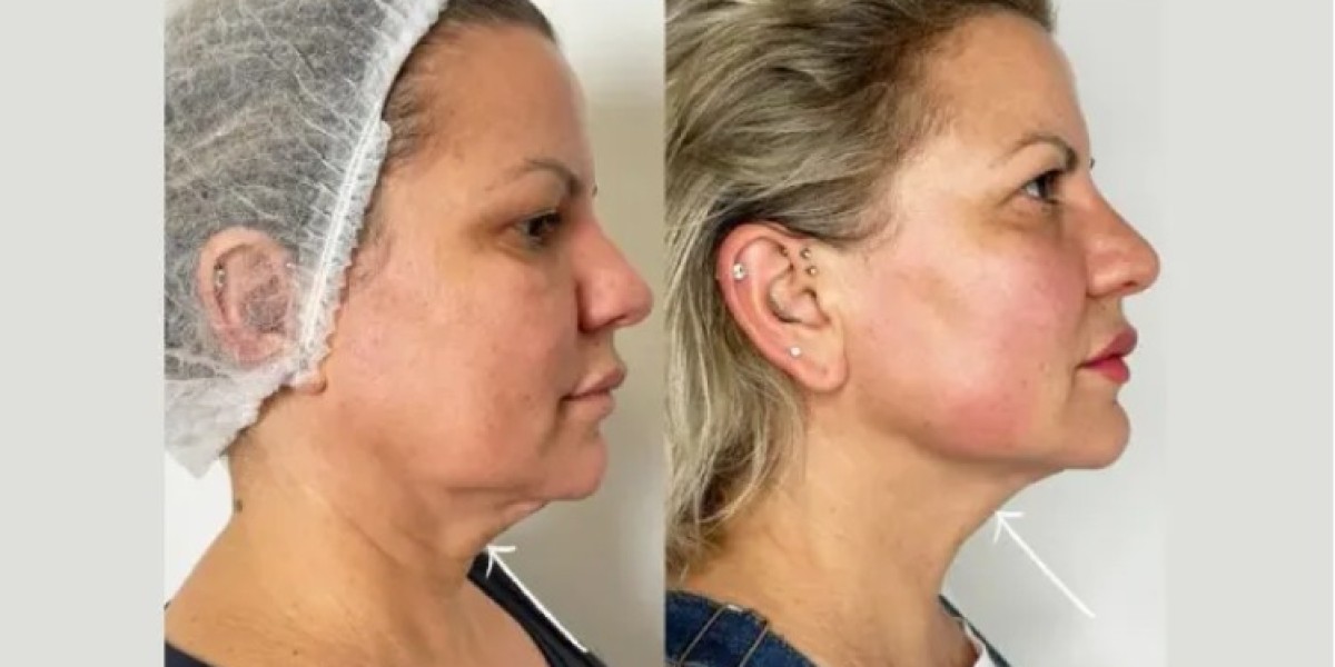 Best Doctors in Dubai: Health and Beauty Experts