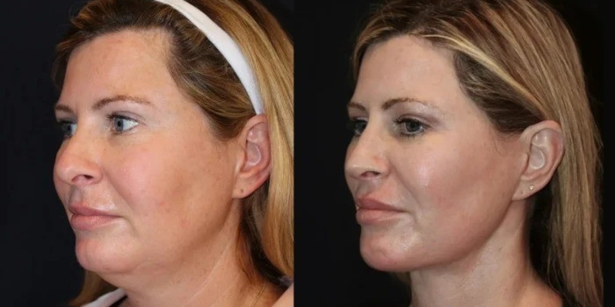 Beauty and Wellness Perfected by the Best Doctors in Dubai