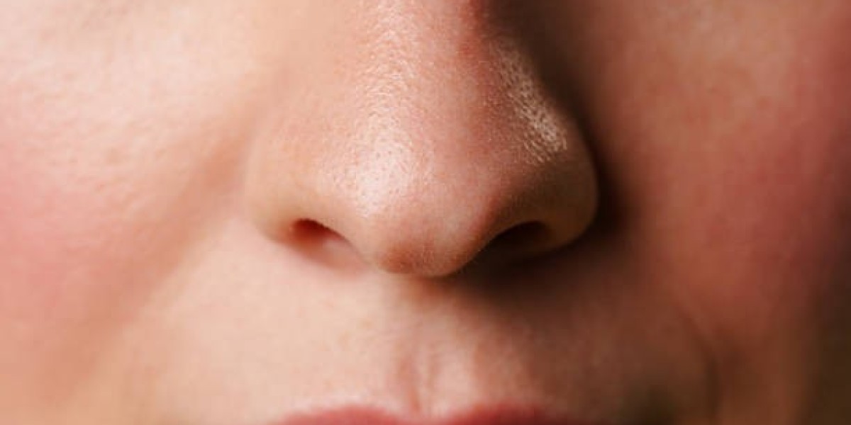 عملية تجميل الأنف: من يحتاجها ومتى يكون الوقت مناسبًا؟