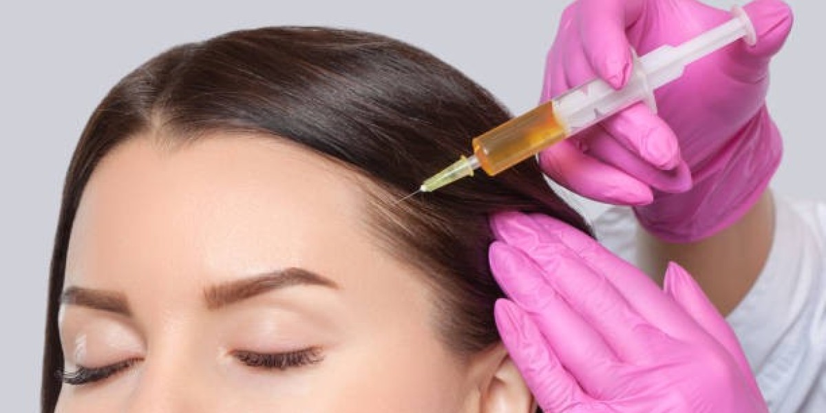 Why PRP Hair Treatment Excels in Promoting Scalp Regeneration Gently