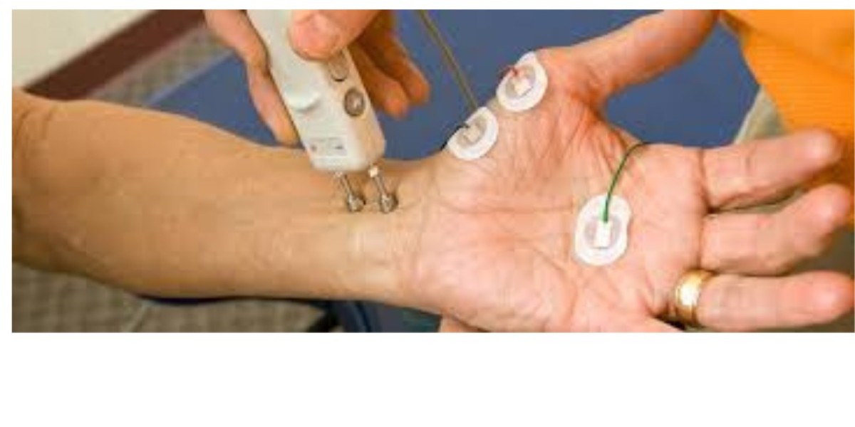 Understanding the Nerve Conduction Velocity Test in Bangalore: A Complete Guide by ecotown