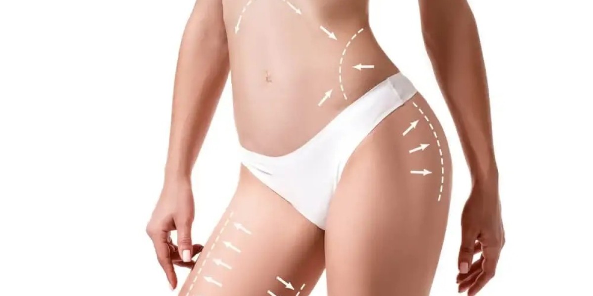 How Long Do Liposuction Results Actually Last?