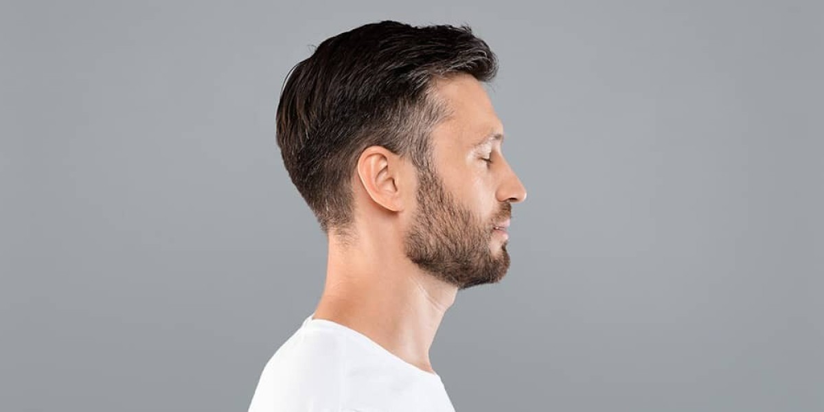 Who Is the Ideal Candidate for a Beard Hair Transplant?