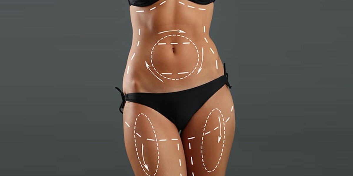 How Much Fat Can Liposuction Really Remove