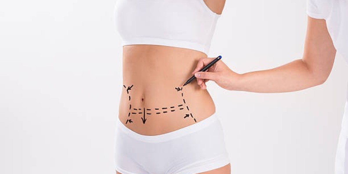 What Are Common Liposuction Procedure Side Effects?