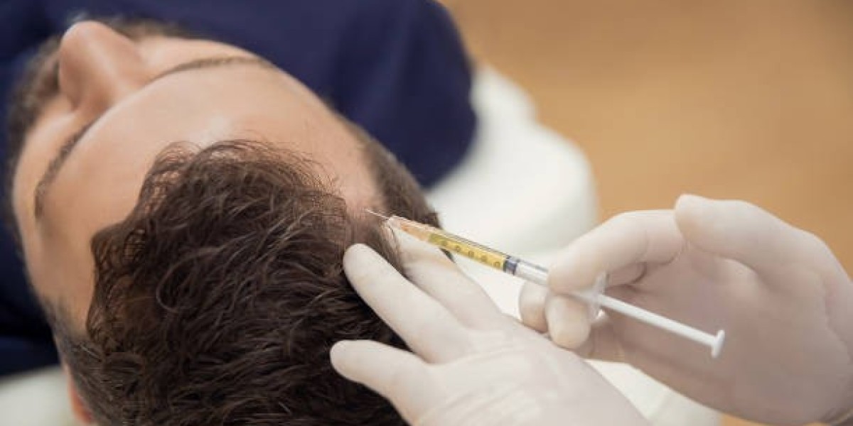 Hair Loss Injections for Regrowth in Aubrey What You Should Know