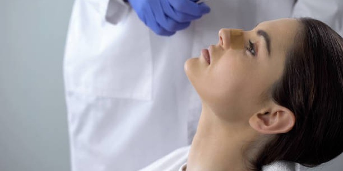 Does Rhinoplasty Require Bone Breaking?