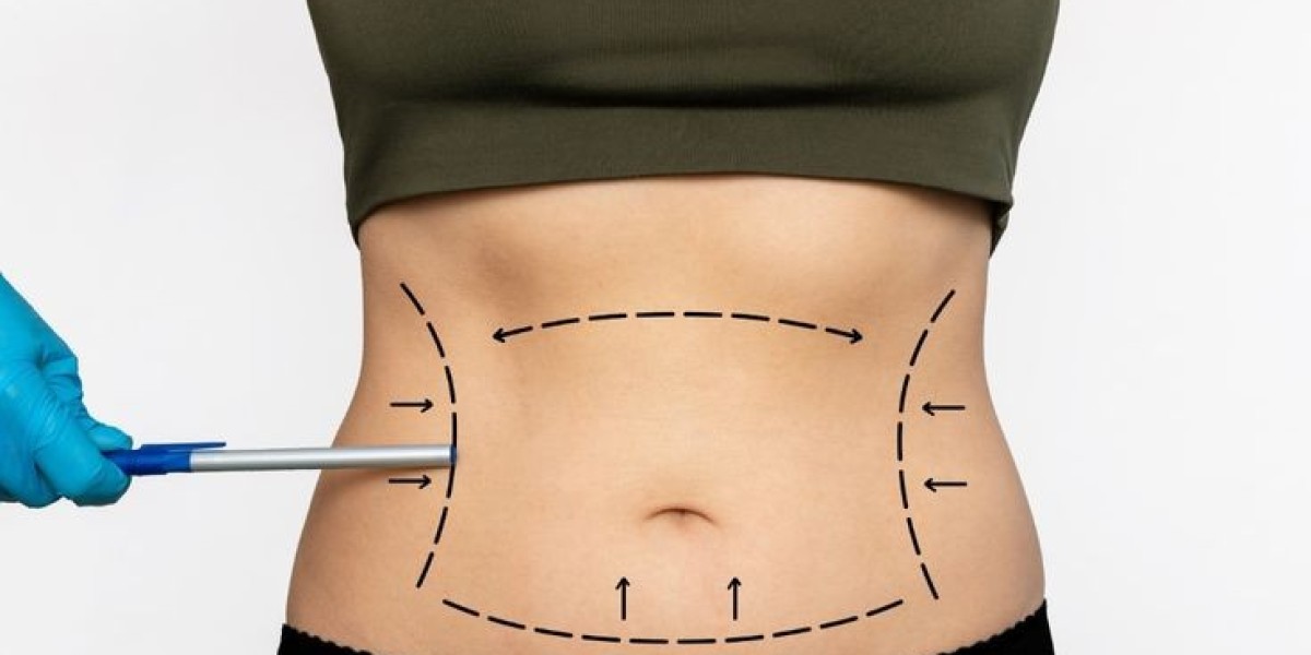 What Vitamins Speed Fractional Liposuction Heal?