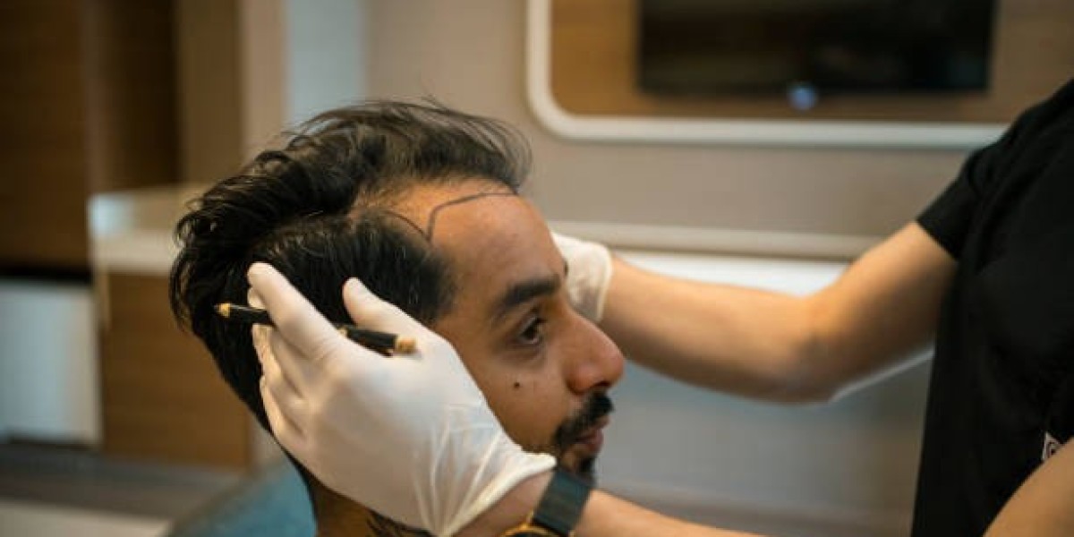 What Next Steps After Hair Transplant Surgery?
