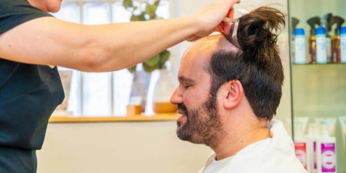 How Hair Transplant in Riyadh Delivers Natural-Looking Hairlines