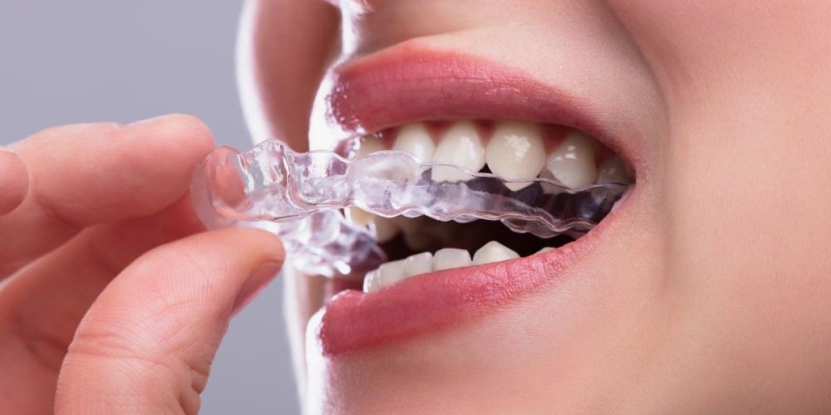 Ursachen und Behandlung von Bruxismus: Ein umfassender Überblick