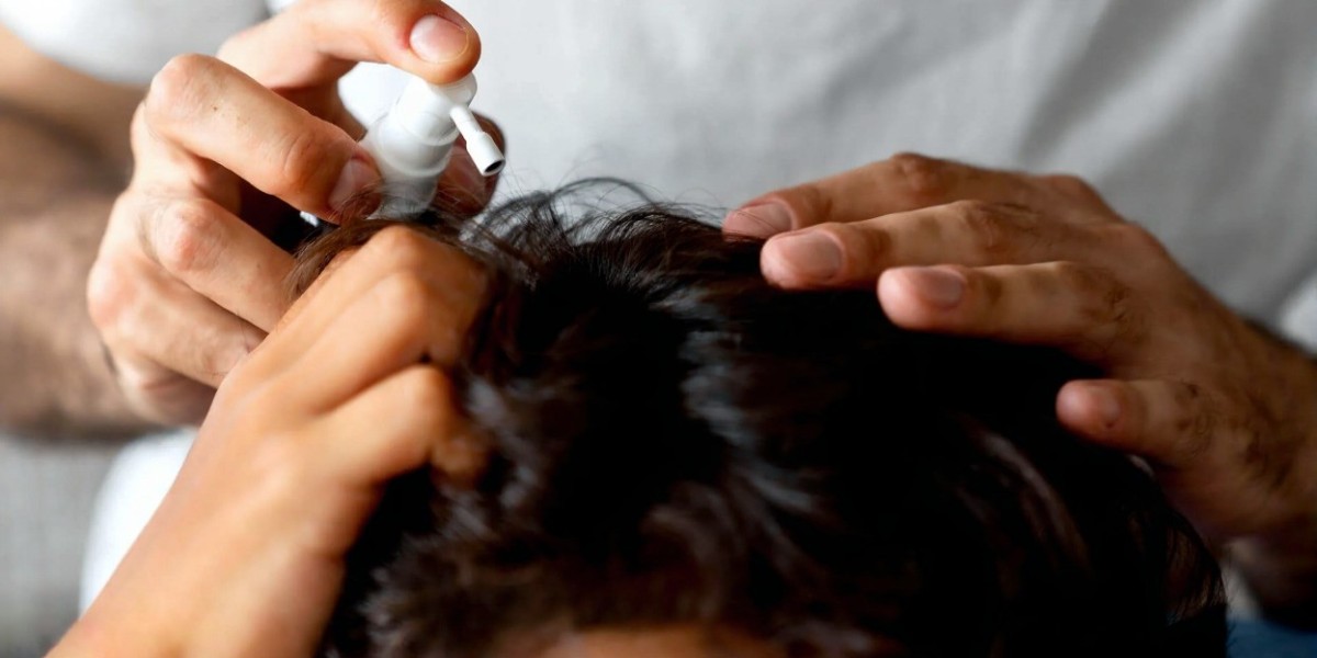 Common Scalp Problems and How to Fix Them