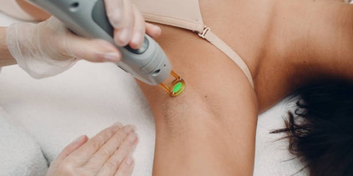 Electrolysis Hair Removal for Eyebrows: Perfect Shape That Lasts