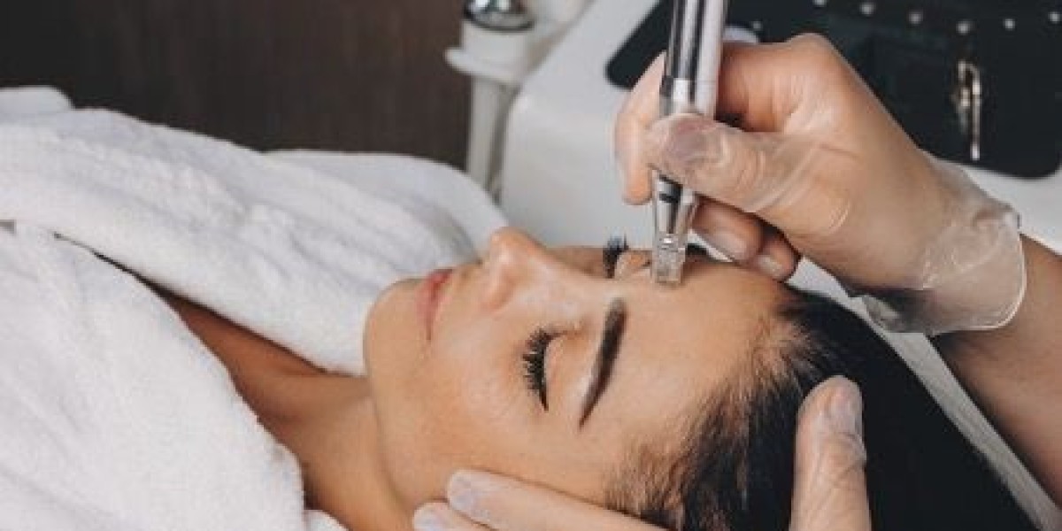 Experience the Magic of Microneedling Treatment in Riyadh