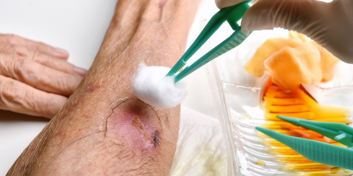 Wound Therapy Devices Market Size & Forecast 2035