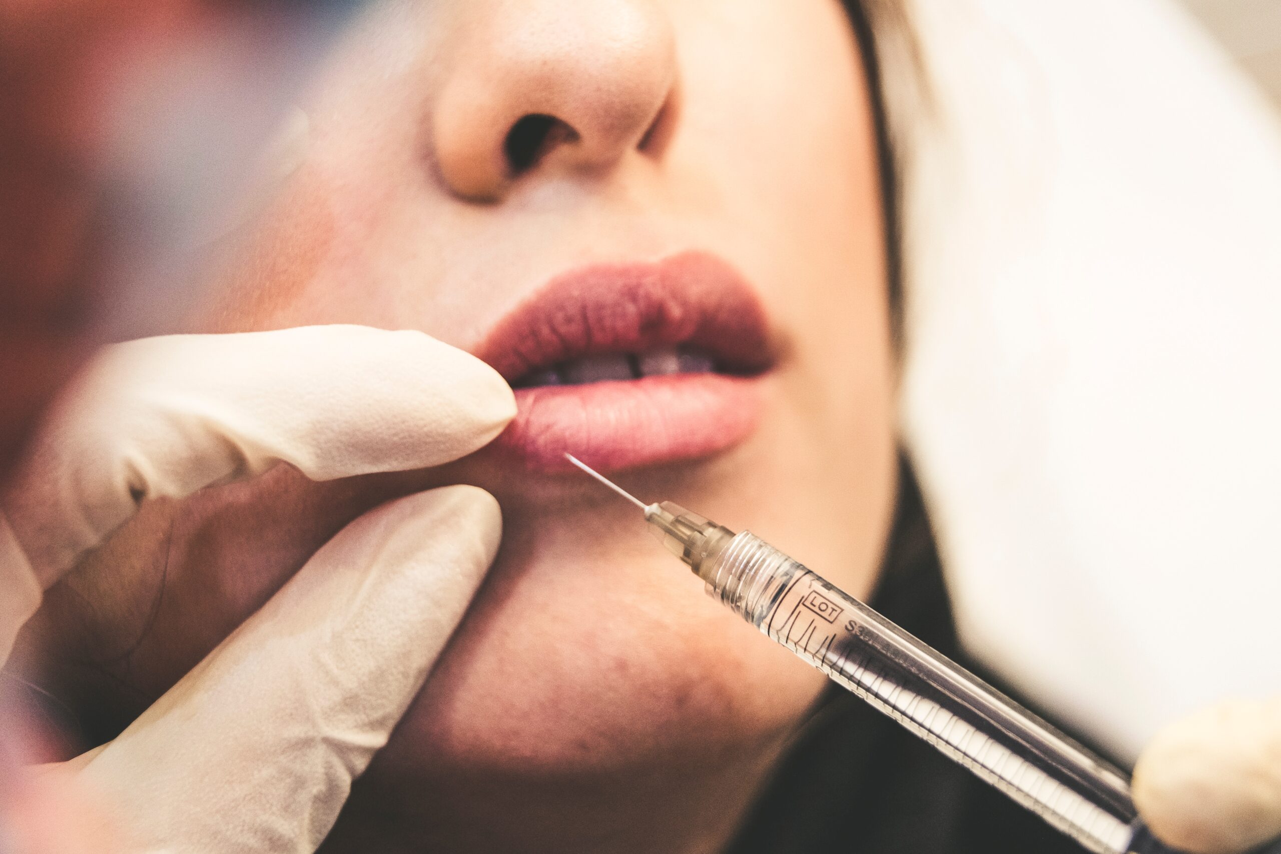 Dermal Fillers London | Dermal Injections London