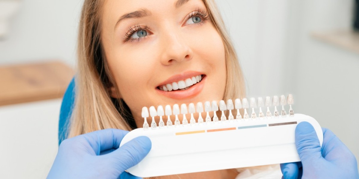Veneers in Dubai: Differences Between Porcelain and Composite
