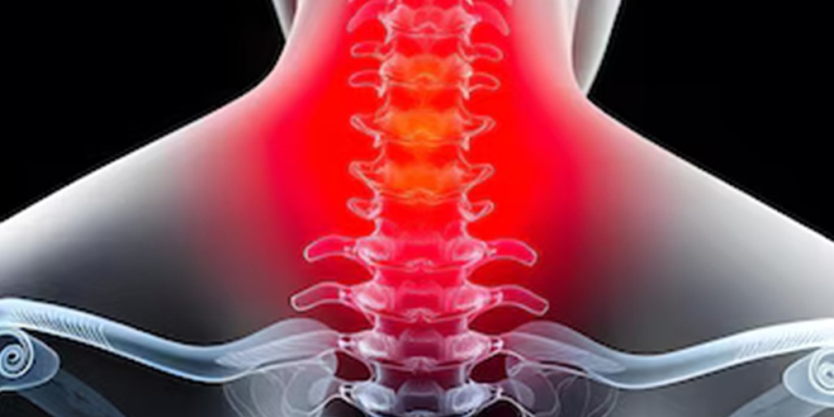 Cervical Radiculopathy NJ