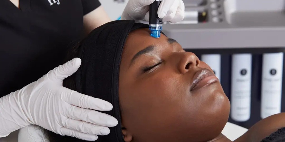 HydraFacial vs Traditional Facials: Scottsdale Expert Insights
