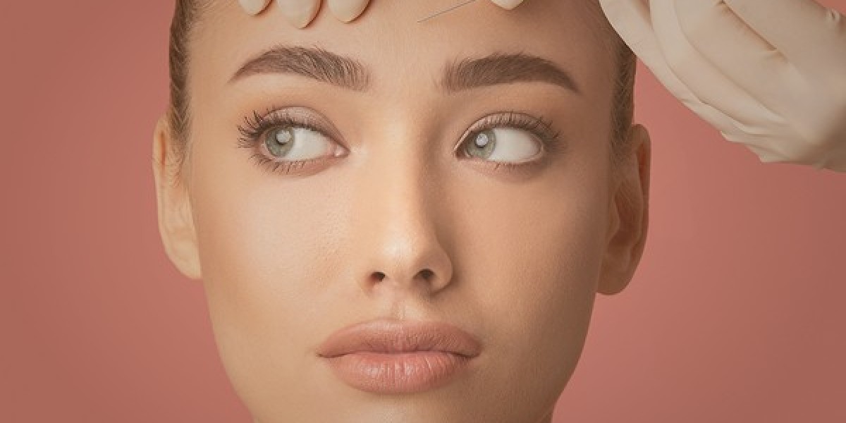 PRP With Microneedling: A Natural Approach to Skin Rejuvenation