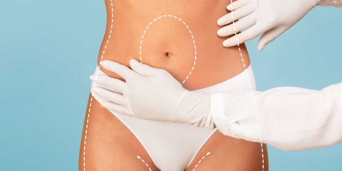 Types of Tummy Tuck: Mini, Full, Extended Explained