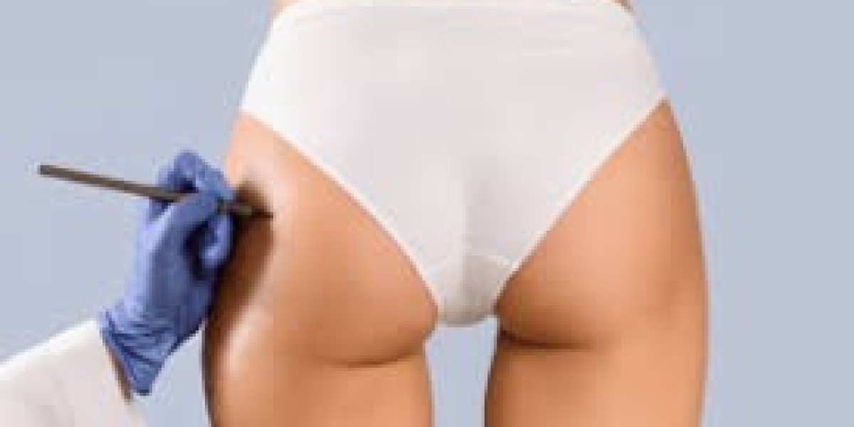 Best Buttock Lift Clinics in Dubai – Safe, Modern Body Contouring Solutions