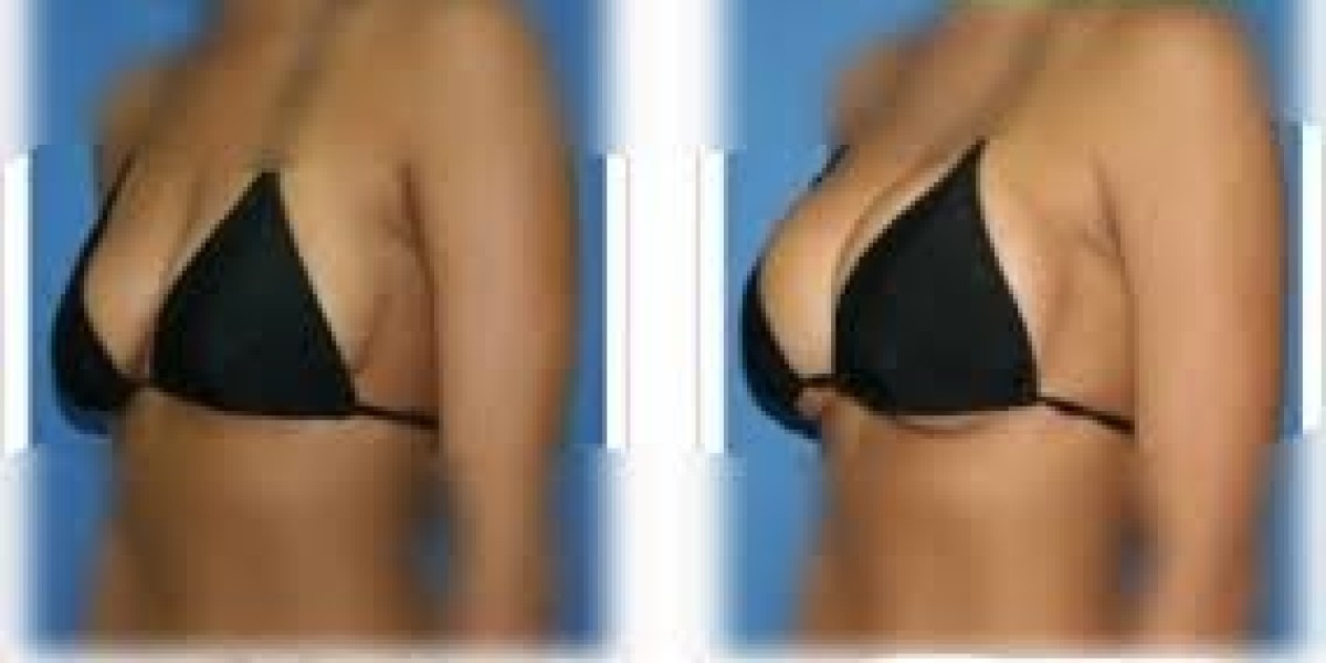 Dubai Board-Certified Breast Surgeons: Expertise, Safety, and Advanced Care in Aesthetic and Reconstructive Surgery