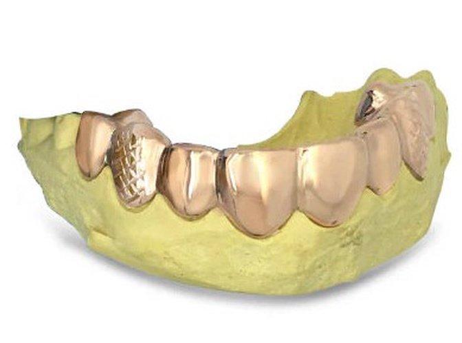 Grillz in Las Vegas: Custom Style That Stands Out | Articles | Zaragoza Jewelry | Gan Jing World - Technology for Humanity | Video & Movie Streaming