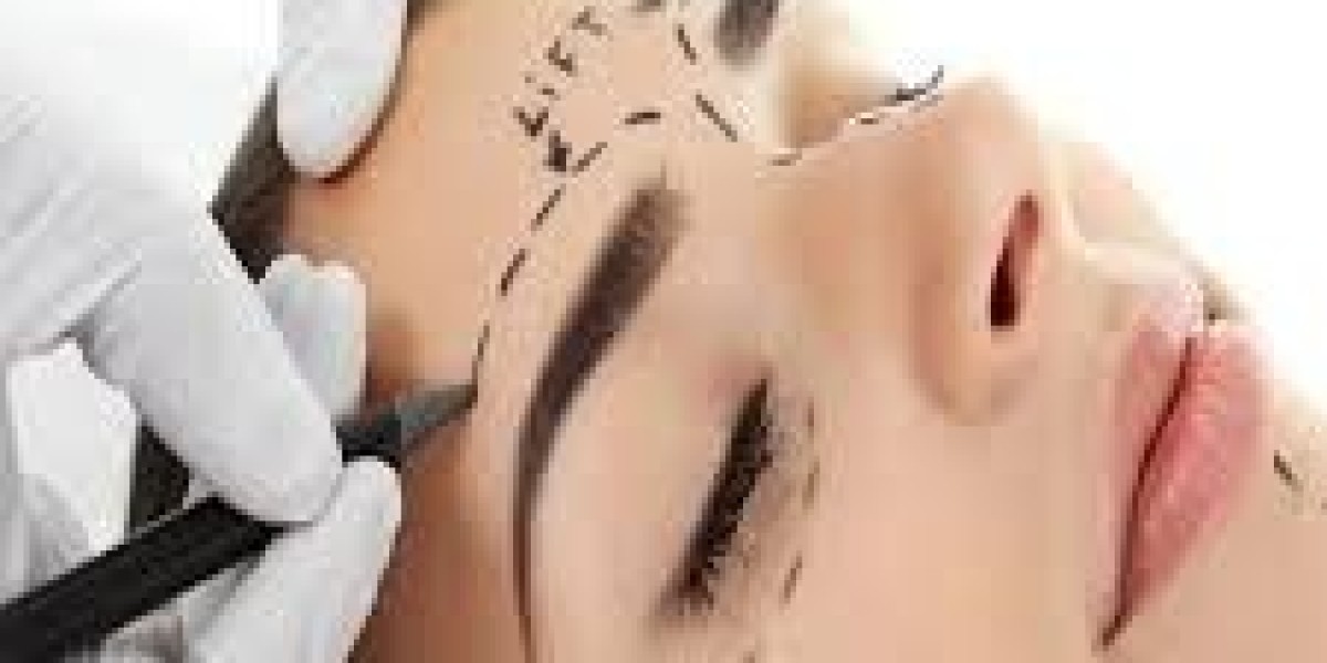 Dubai Forehead Rejuvenation Surgery Experts: A Complete Guide to Youthful Forehead Enhancement