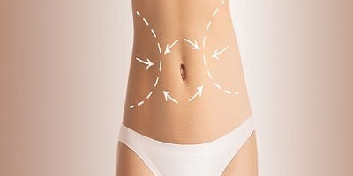 Advanced Liposculpture Techniques in Dubai for Precision Body Contouring
