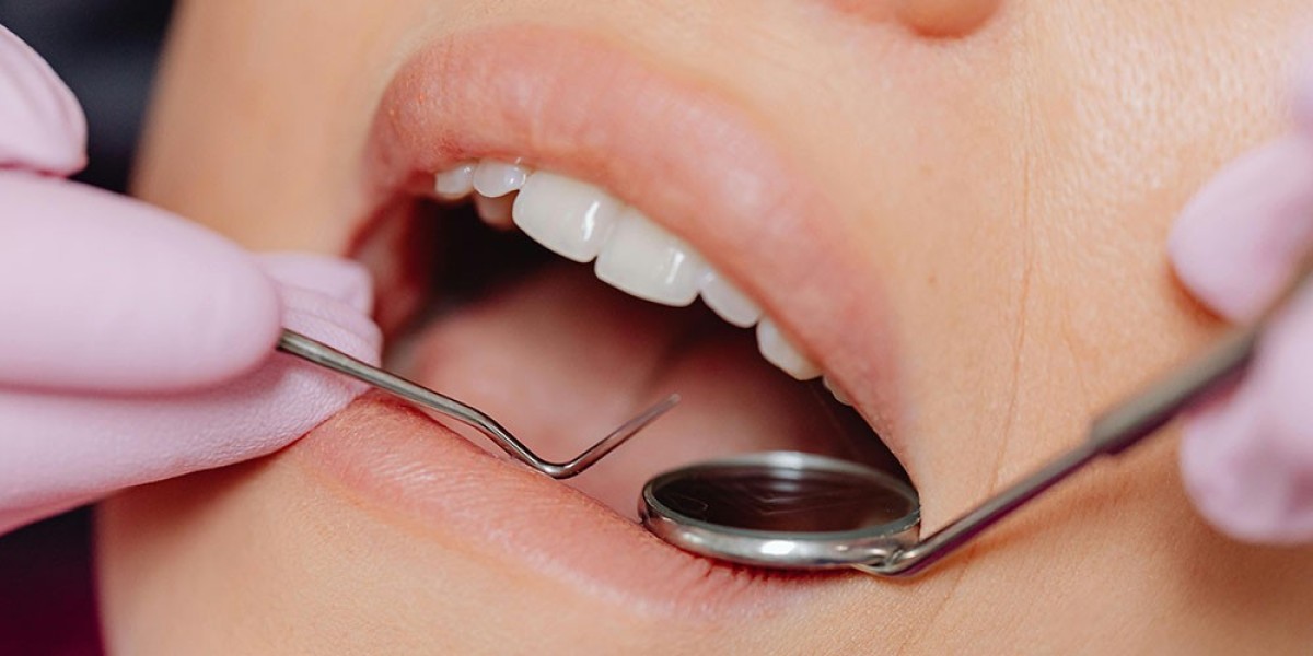 Teeth Cleaning and Periodontal Health