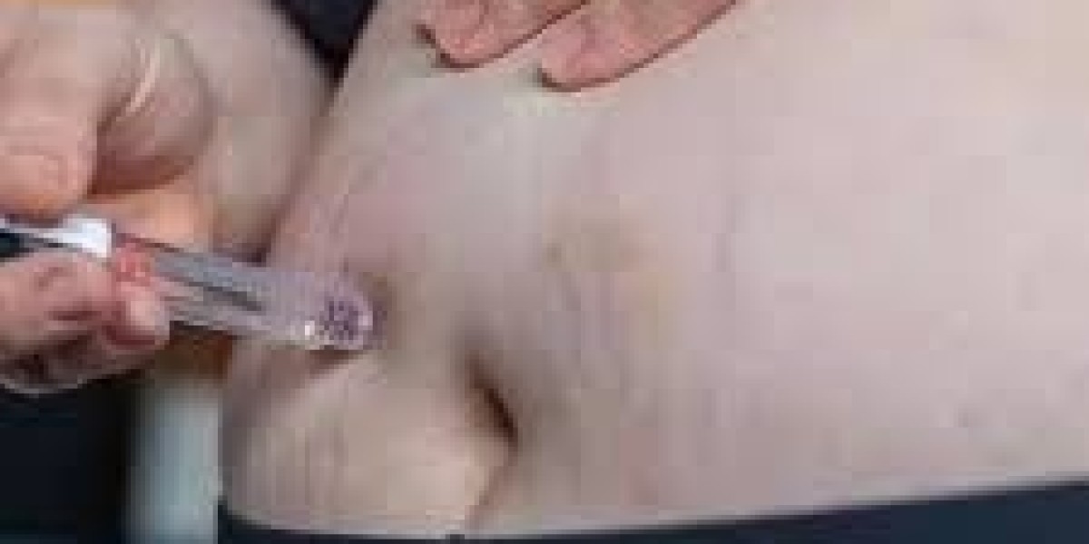 Best Saxenda Injection Providers in Dubai for Safe Medical Weight Management