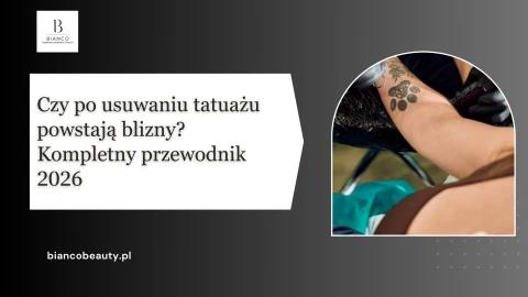 Czy po usuwaniu tatuażu powstają blizny Kompletny przewodnik 2026