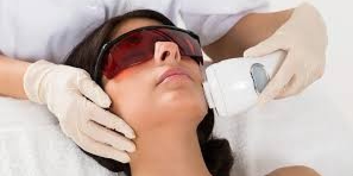 Safe Laser Hair Bleaching Treatments in Dubai: A Complete Guide to Gentle Facial Hair Lightening