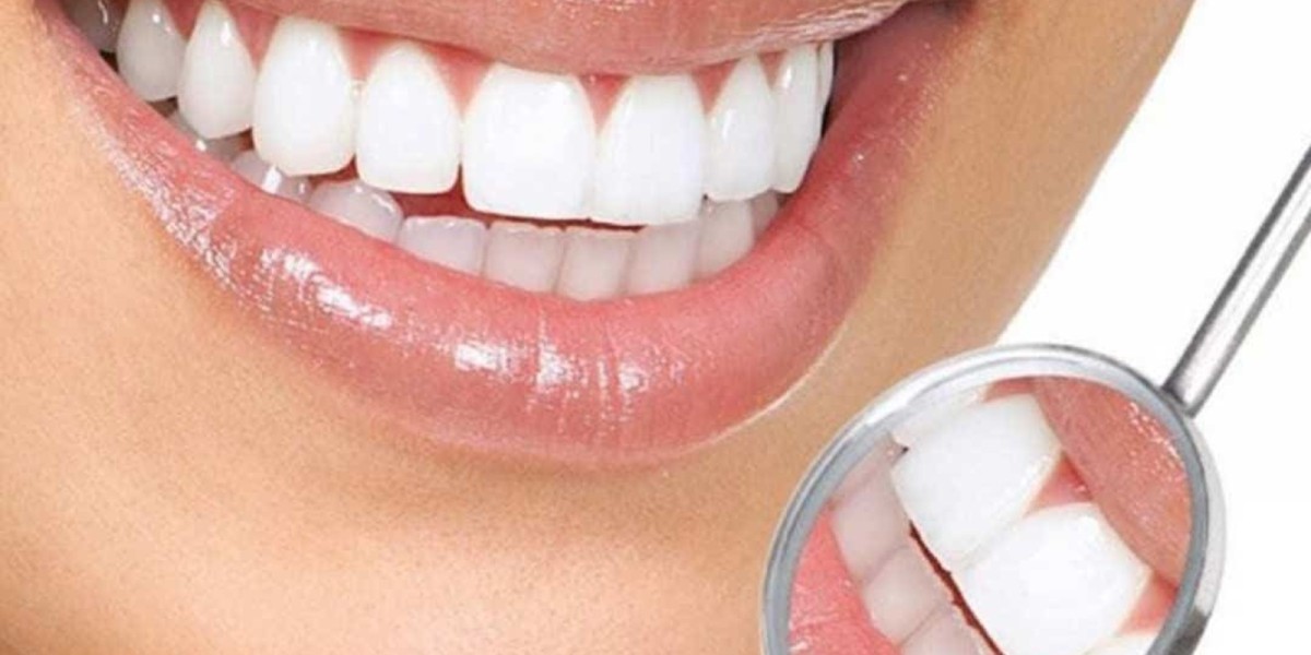 Dental Clinic in Dubai Advanced Cosmetic Dentistry