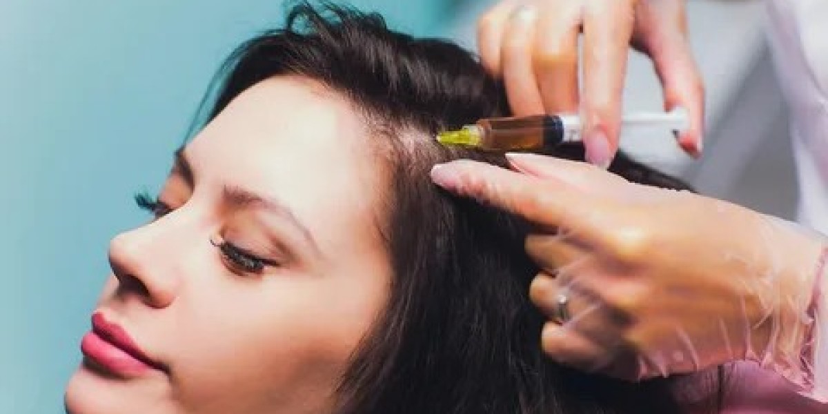 PRP Hair Treatment in Dubai: Sustainable Results for Hair