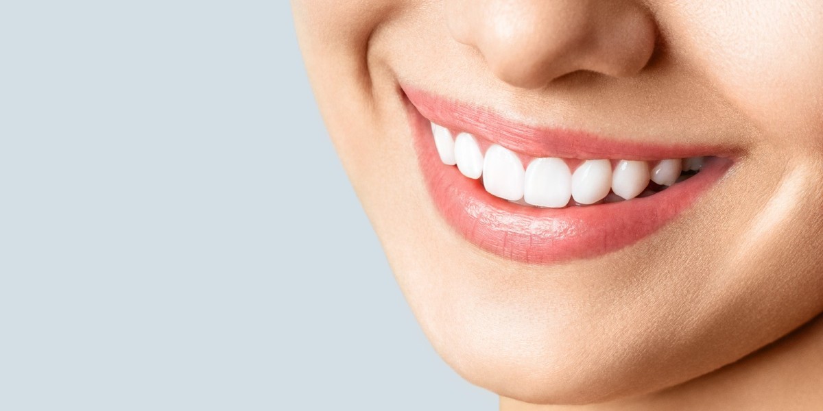 Teeth Whitening Dubai Cosmetic Dentistry Guide