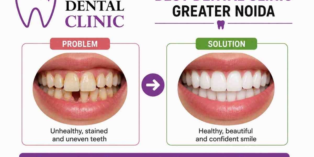 Best Dentist Greater Noida | Prime Dental Clinic for Trusted Dental Care