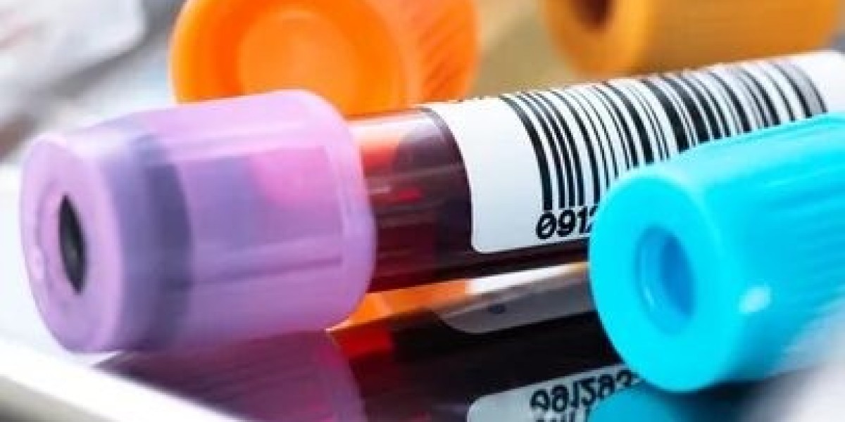 Cortisol Blood Test: Causes of Abnormal Cortisol Levels