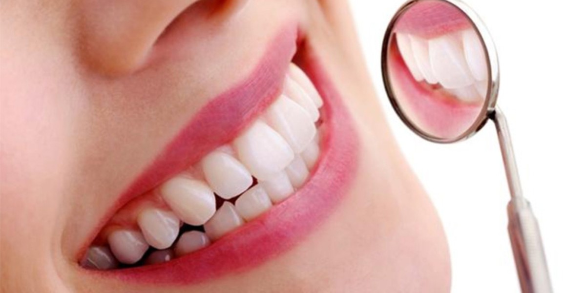Teeth Cleaning Dubai: Enhance Your Smile Naturally