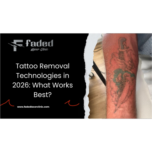 Tattoo Removal Technologies in 2026: What Works Best?
