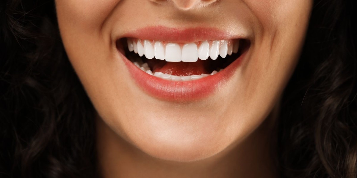 Which Is the Best Clinic for Zoom Teeth Whitening in Dubai?