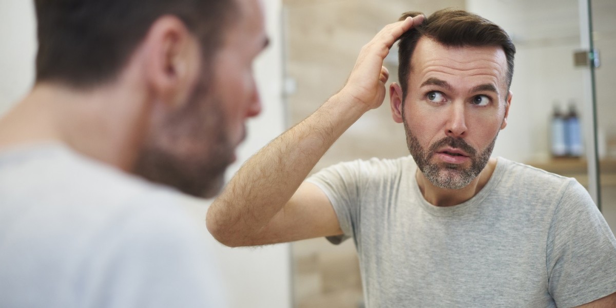 Modern Approaches to Treating Hair Loss and Restoring Natural Growth