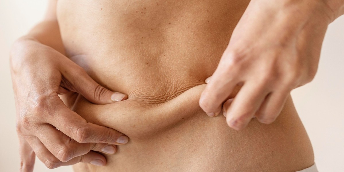 The Growing Popularity of Liposuction in Dubai Explained