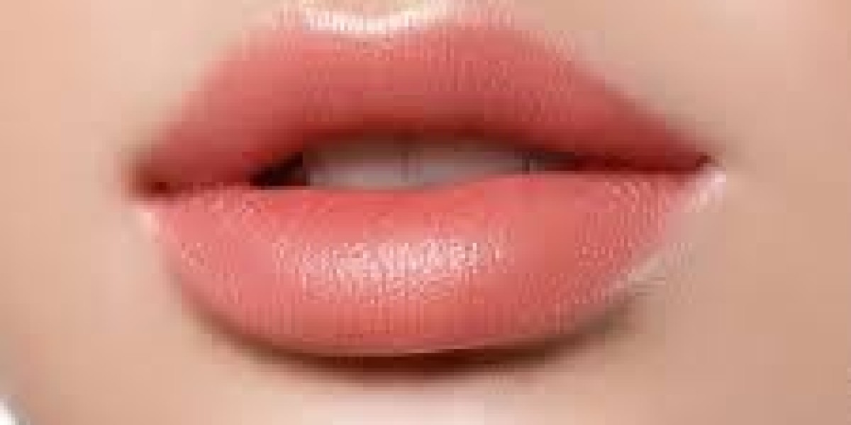 Russian Lip Filler in Dubai – Natural Lift, Shape & Modern Lip Enhancement