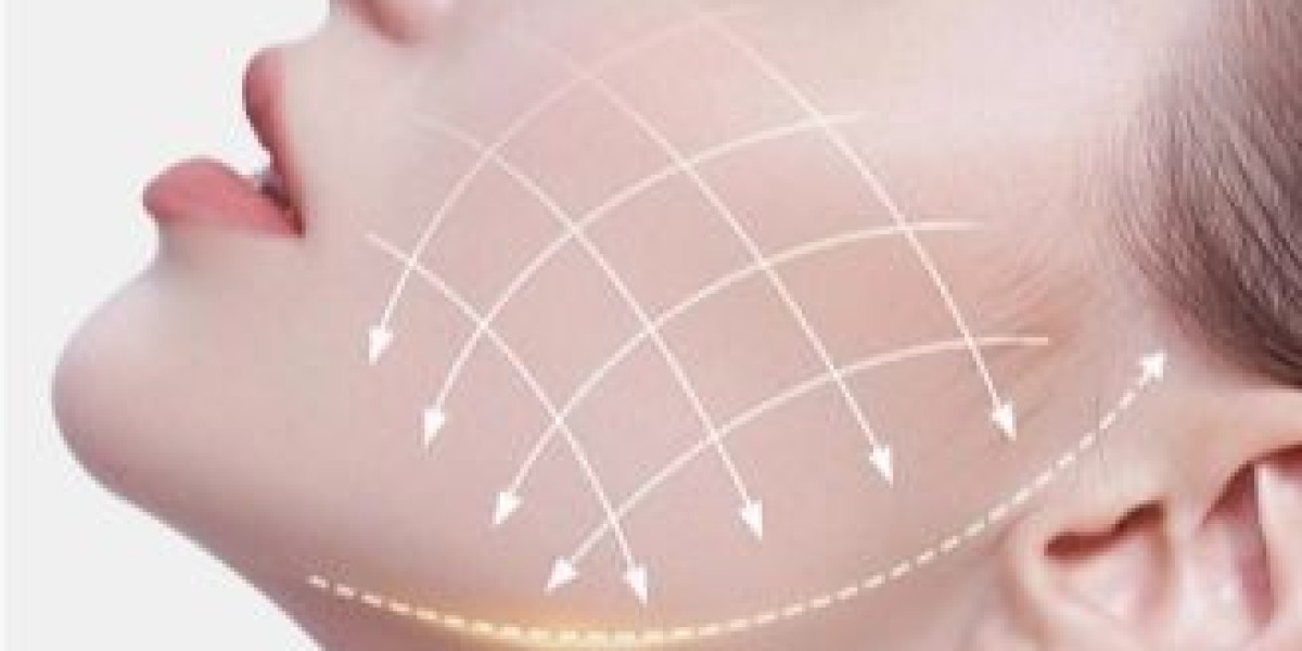 Endolift Treatment in Dubai: Expert Non-Surgical Results
