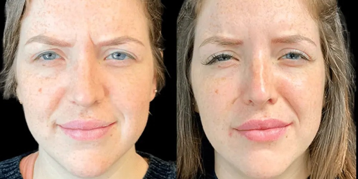Best Aesthetic Clinics in Dubai: Expert Guide to Choosing Right Botox Provider