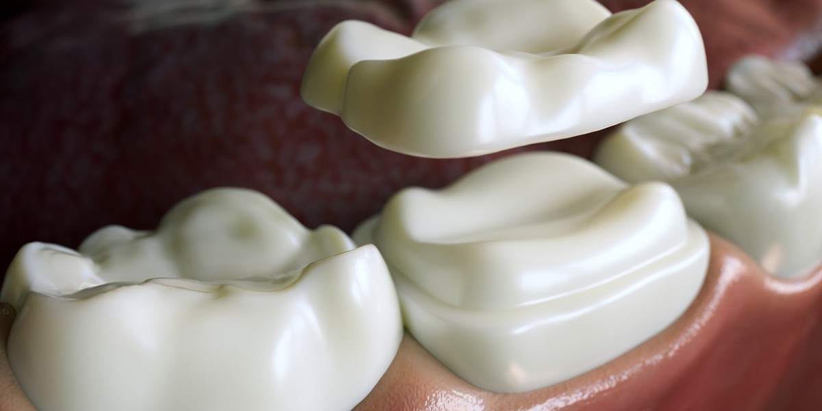 Dental Tooth Filling for Tooth Decay Prevention