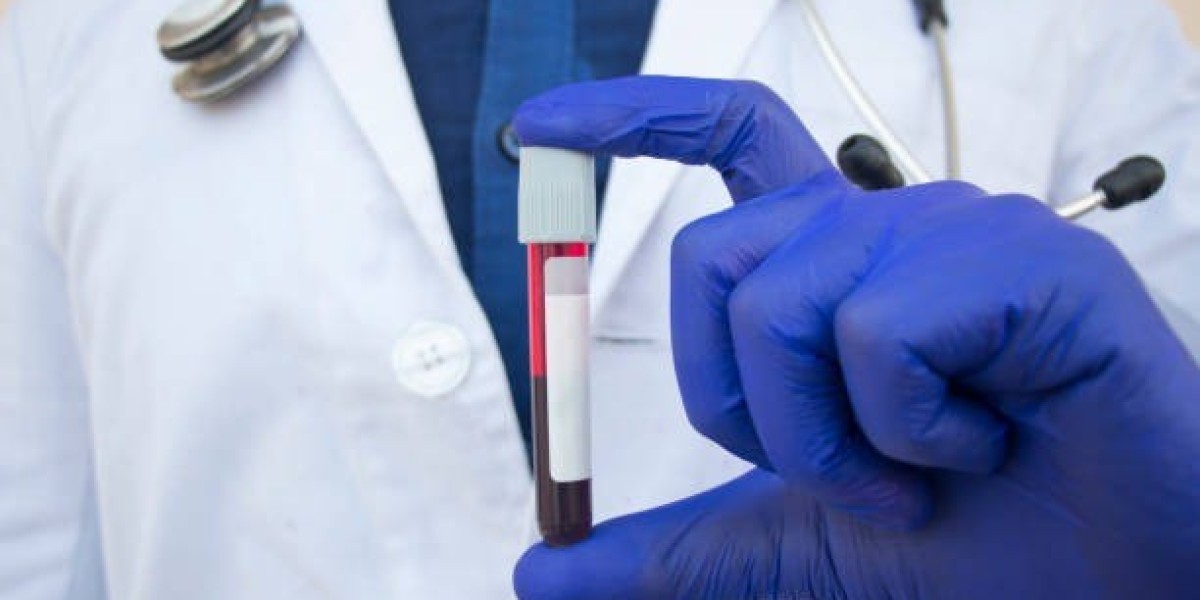 Blood Test At Home in Dubai | Home Sample Collection with Comfort