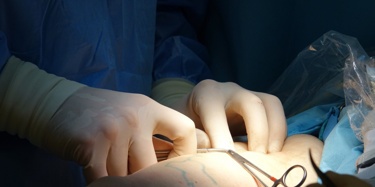 Advanced Options for Hymen Repair Surgery in Dubai Explained